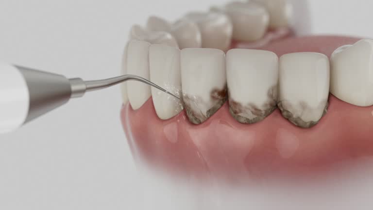 Trusted Invisalign Clear Aligners service in Williston, ND - Dentist Open Now